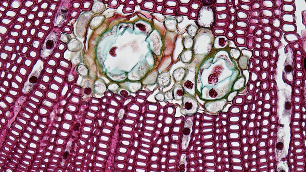 Microsoft and Paige Release PRISM2 Research Model for Multimodal Pathology AI