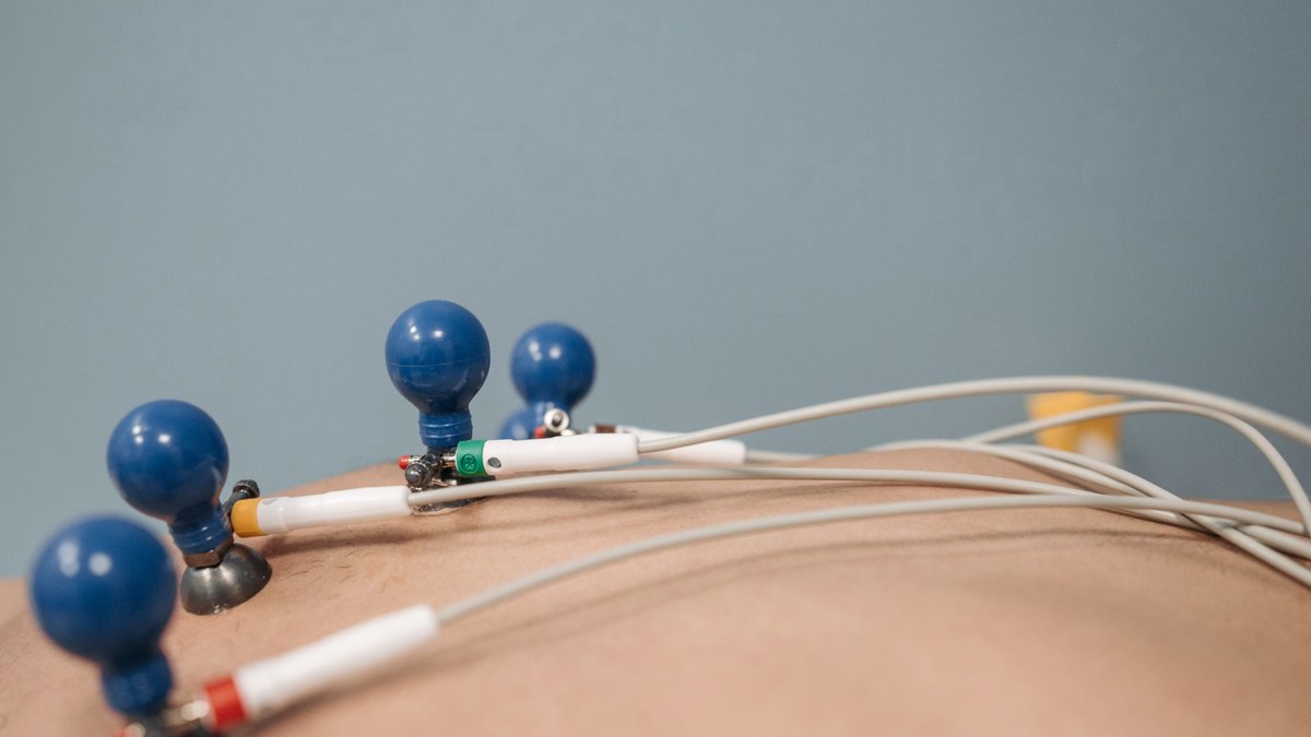 AI sleep-study model surfaces hidden long-term health risks in routine lab data