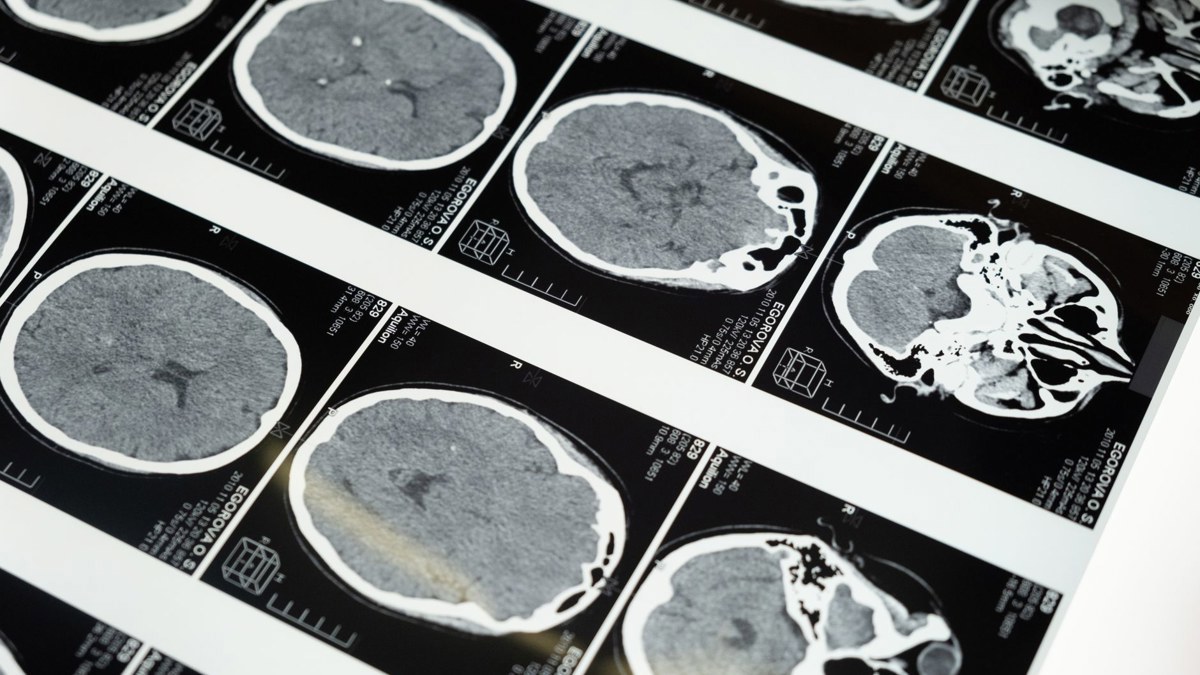 Google Cloud and MLCommons move MedPerf medical AI benchmarks into confidential computing